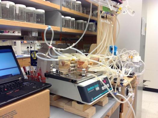 Kansas City: Voters weigh unusual tax to fund medical research