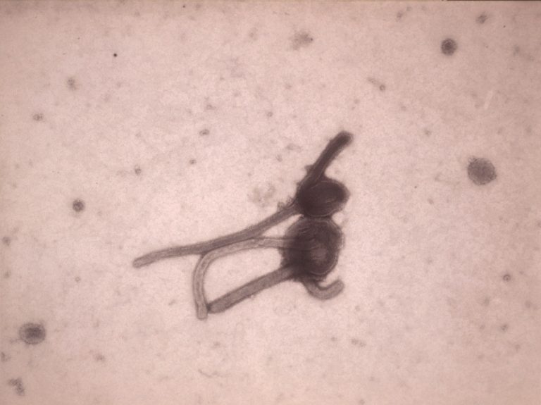 This undated photo made available by the Antwerp Institute of Tropical Medicine in Antwerp, Belgium, shows the Ebola virus viewed through an electron microscope. The World Health Organization on Friday, Aug. 8, 2014 declared the Ebola outbreak in West Africa to be an international public health emergency that requires an extraordinary response to stop its spread. (AP Photo/Antwerp Institute of Tropical Medicine)