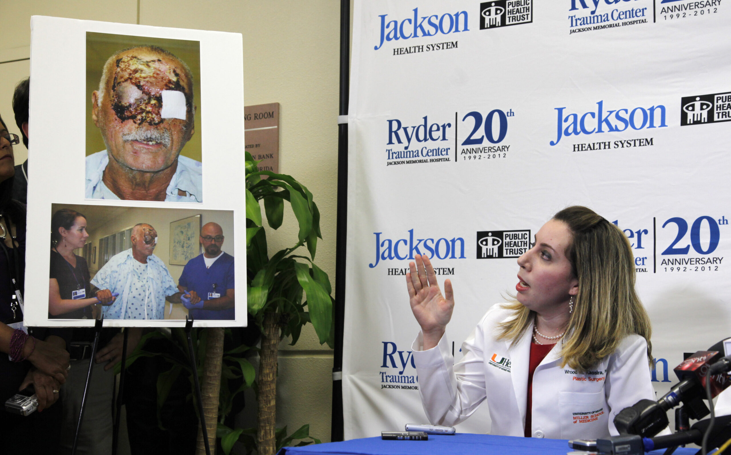 Doctors: Face-chewing victim ‘awake and alert’