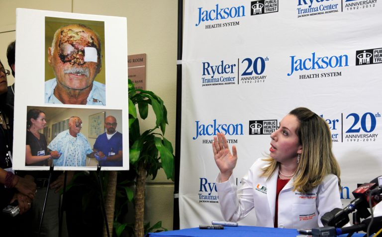   EDS NOTE: GRAPHIC CONTENT - Dr. Wrood Kassira, right, a University of Miami/Jackson Memorial Hospital plastic surgeon, gestures as she speaks on the condition of Ronald Poppo, pictured at left, during a news conference, Tuesday, June 12, 2012 in Miami. Poppo was a homeless man whose face was mostly chewed off in a bizarre attack along a busy Miami street May 26. (AP Photo/Wilfredo Lee)  