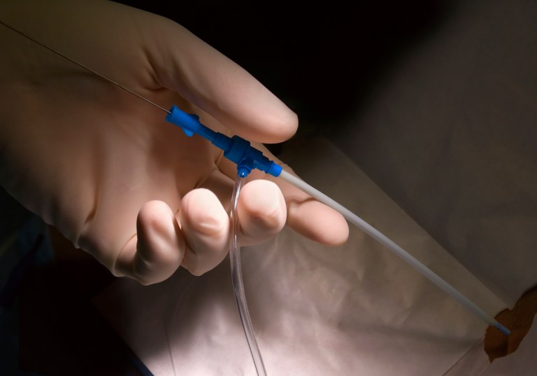 Obamacare created a 2.3 percent excise tax on the manufacture and import of medical devices. This tax doesn't really fall on patients, except in very indirect ways. (Thinkstock)