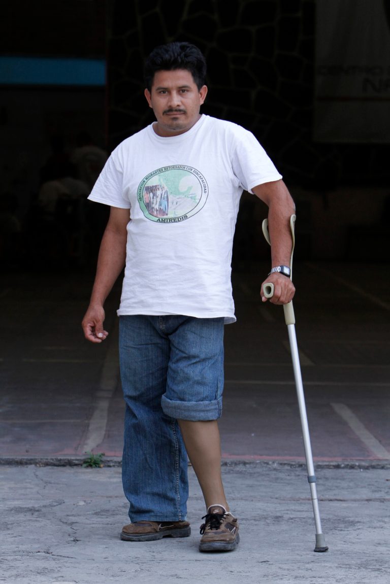Fredy Vegas, 33, a migrant from Honduras who uses a prosthetic leg after loosing his limb while riding the train through Mexico toward the U.S. border, poses for a portrait at a migrant shelter in Mexico City, Wednesday, April 9, 2014. Vegas is in Mexico City, along with other Honduran migrants who lost limbs after falling from trains during northbound journeys across Mexico, to ask the country's Senate to stop the government's persecution of Central Americans and protect them from criminal gangs. (AP Photo/Marco Ugarte)
