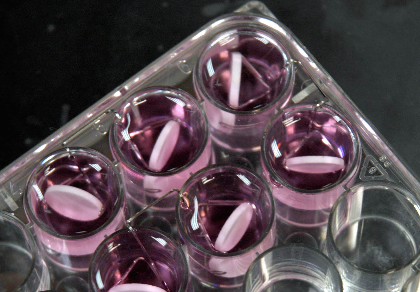 Surgery, chemotherapy infections ripe for superbugs