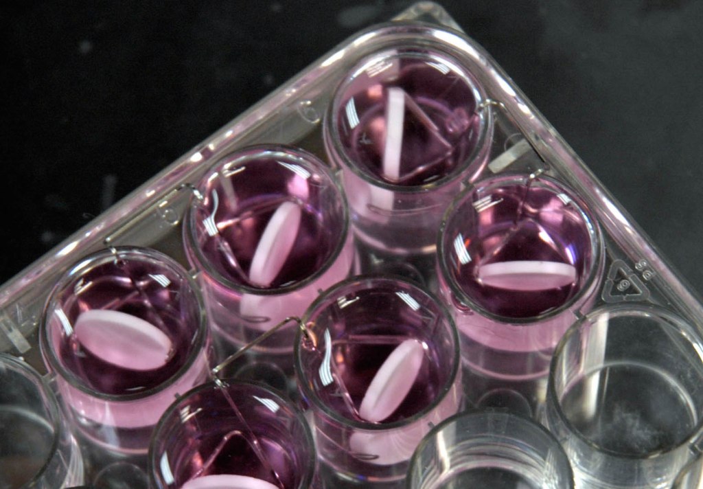 Surgery, chemotherapy infections ripe for superbugs