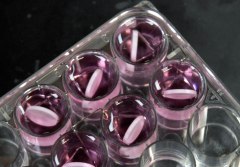 Surgery, chemotherapy infections ripe for superbugs