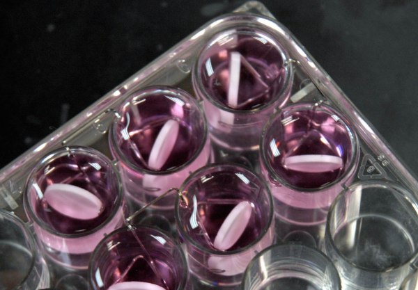 Surgery, chemotherapy infections ripe for superbugs