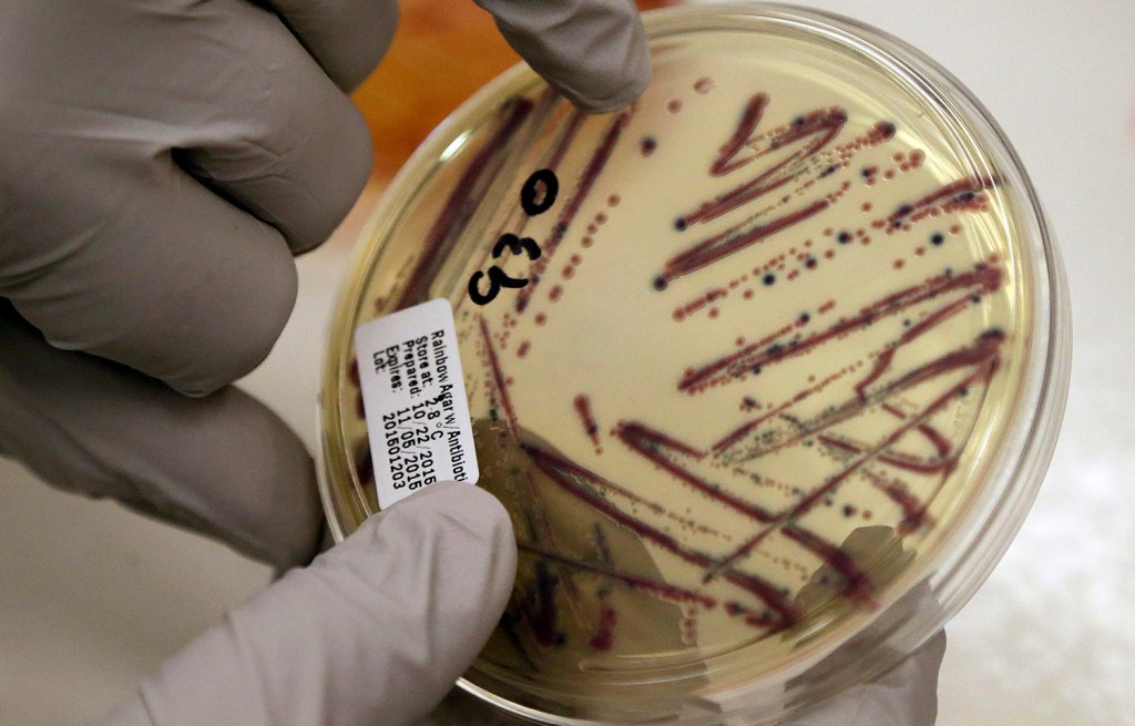 Deadly superbug found in U.S.
