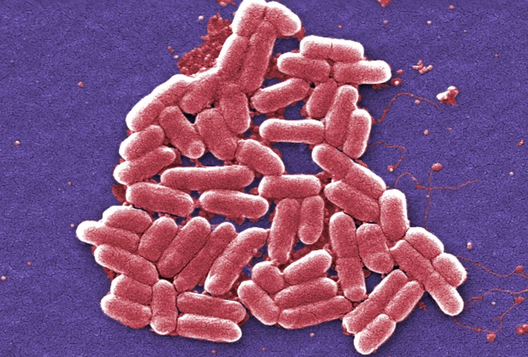 CDC is looking for people who came in contact with woman who got the antibiotic-resistant version of E. coli. (Janice Carr/CDC via AP)