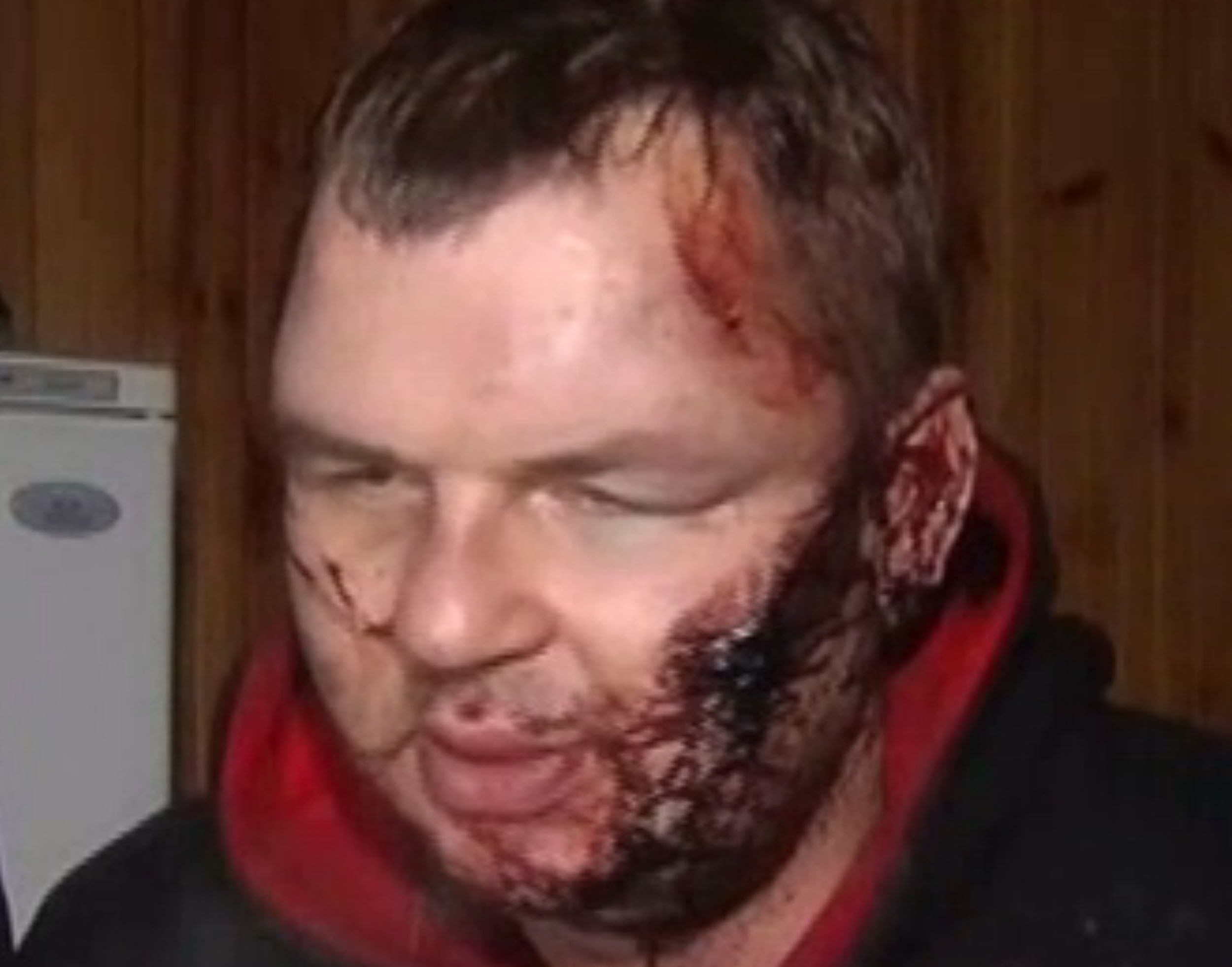 Ukraine activist’s story fuels torture squad fears