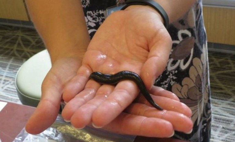 New species of blood-sucking leech identified in swamps outside DC