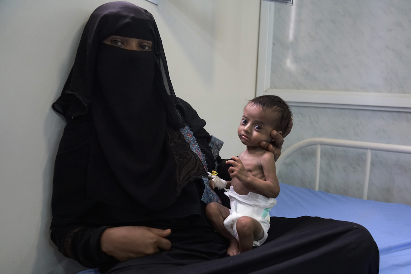 America’s Balancing Act in Yemen