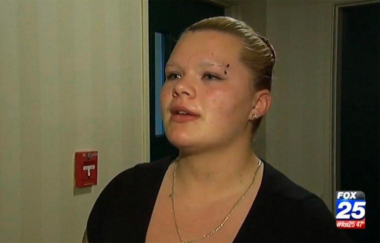 Taylier Tibbetts accused the father of her child of abusing the boy, and even went so far as to alter photos of her son to make him appear bruised. She also opened a GoFundMe account to raise money for herself and her son using the false claim. (Screenshot: Fox News)