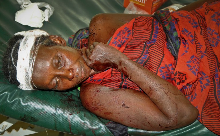   An injured woman is treated at the district hospital in Malindi Friday, Dec. 21, 2012, following tribal clashes in Kipao village in the Tana River Delta region of southeastern Kenya. At least 39 people including men, women, children, and attackers, were killed when farmers from the Pokomo tribe, armed with spears and AK-47 rifles, raided a village of semi-nomadic Orma herders early Friday in renewed fighting between two communities with a history of violent animosity, a police official said. (AP Photo)  
