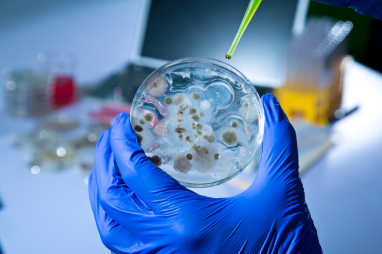 The samples were supposed to have been inert for medical training but were discovered to potentially be live samples.Â 