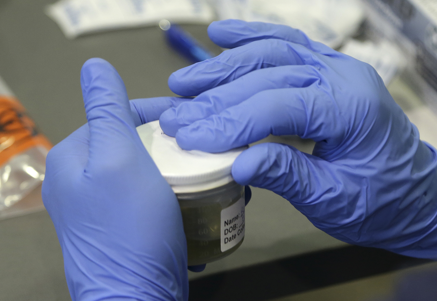 Feds boost U.S. labs’ ability to test for Zika