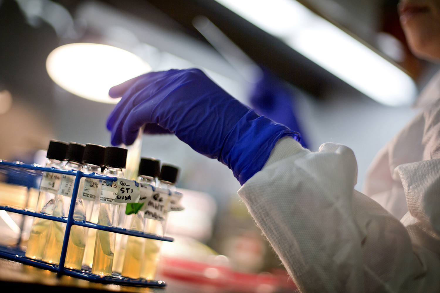 Superbug found in Connecticut child