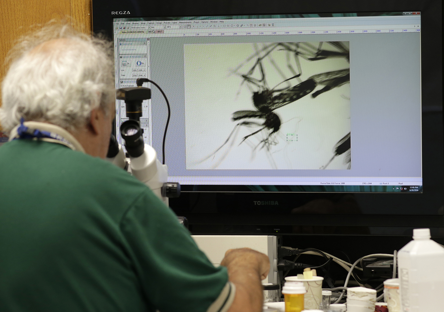 Zika might stay in the blood longer than CDC thought