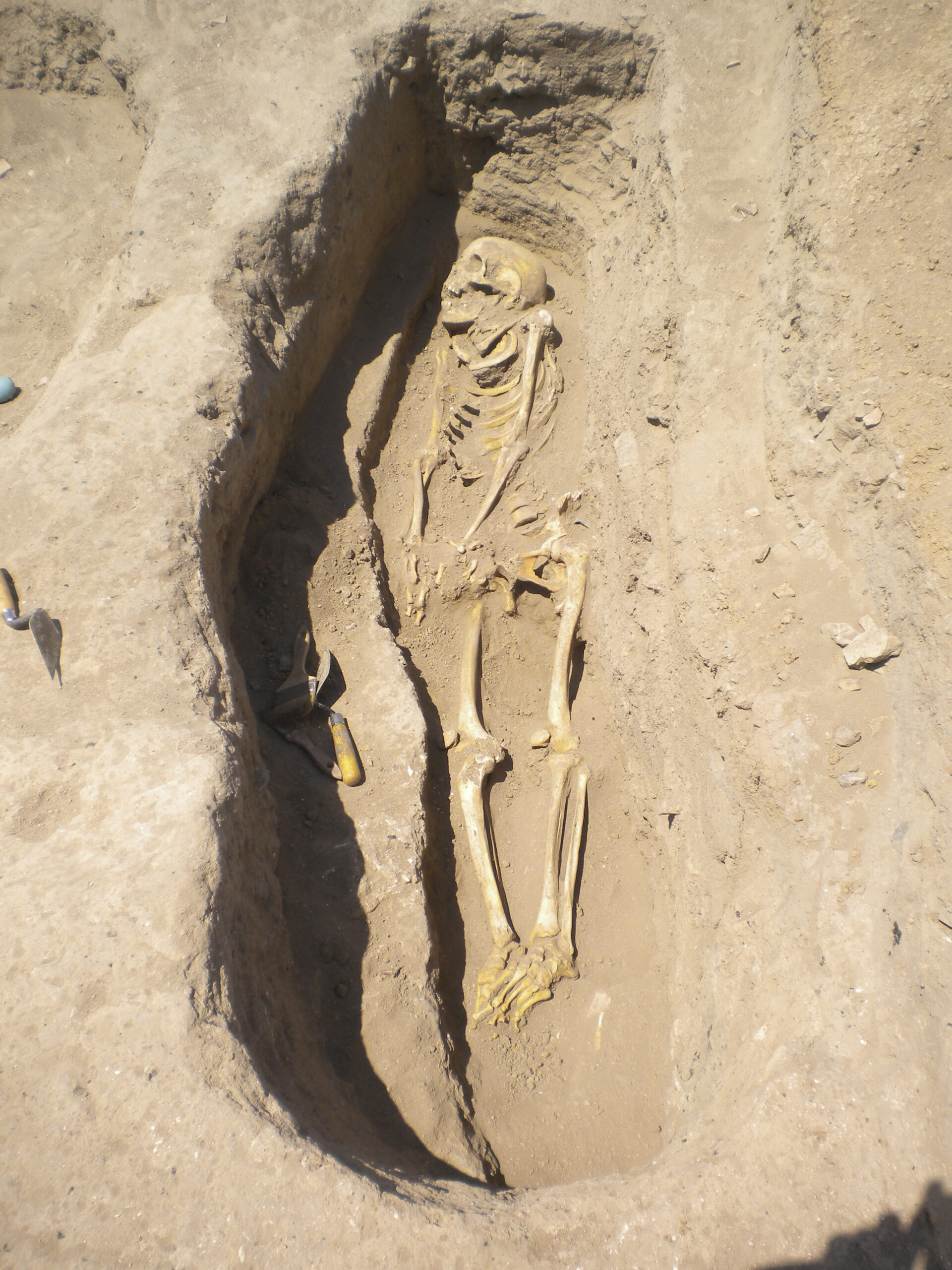 Scientists find 6,200-year-old parasite egg