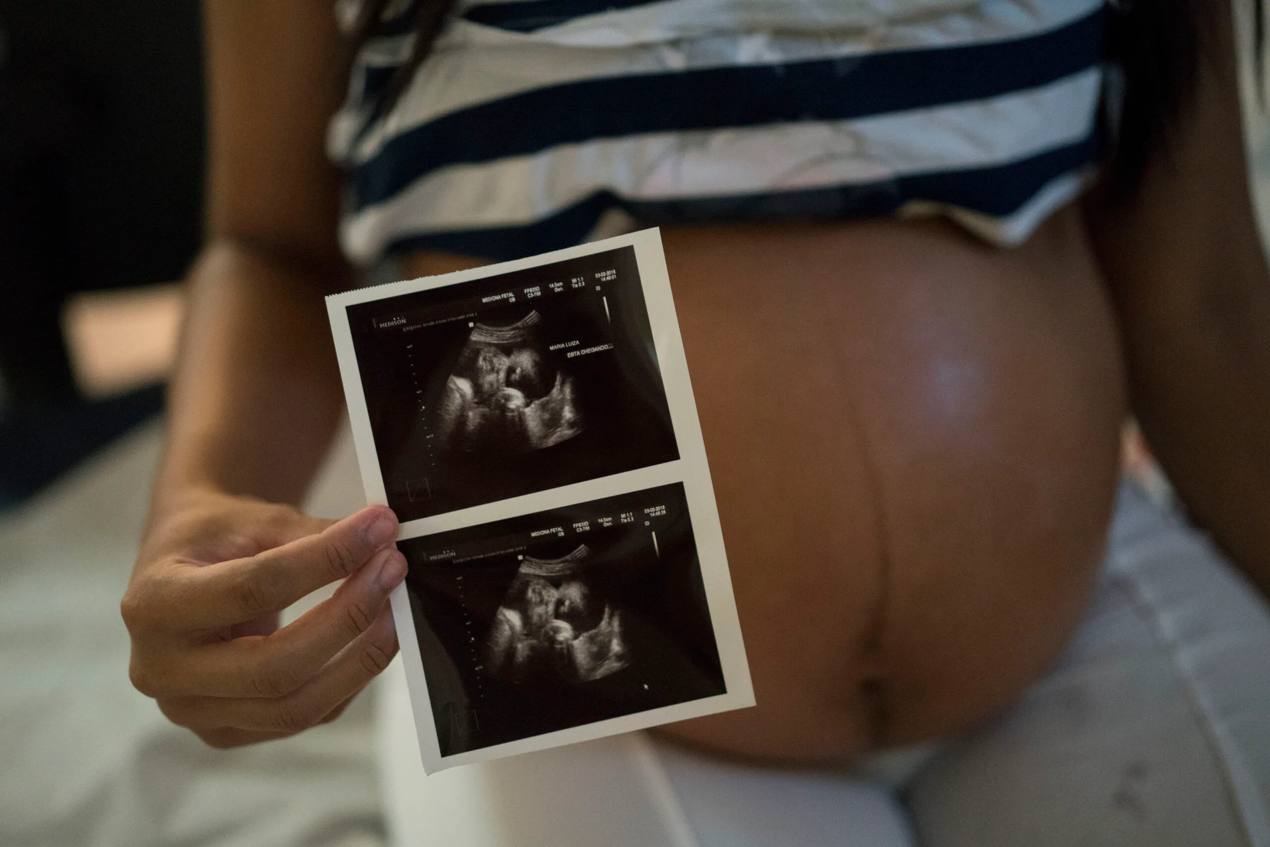 Why won’t Planned Parenthood show women their ultrasounds?