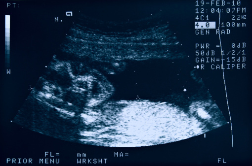 Virginia health board OKs tougher rules for abortion facilities