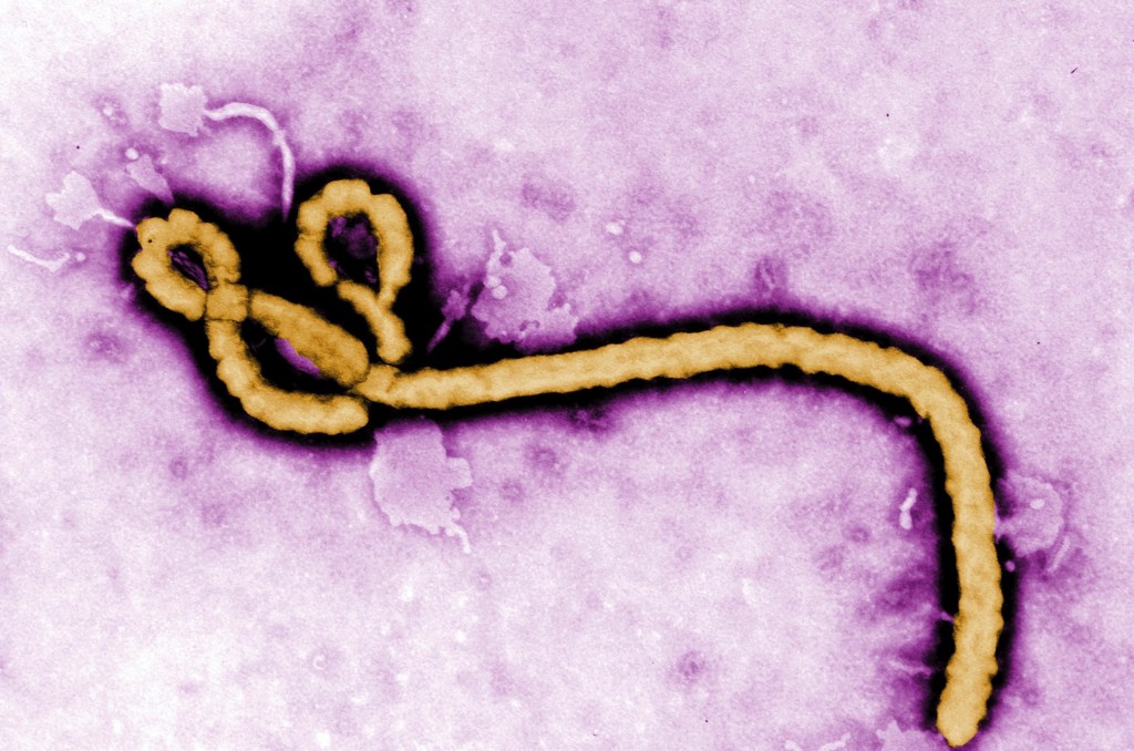 Trump scraps plan to cut Ebola funds
