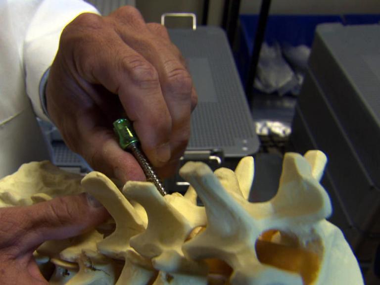 CBS News: Surgeon salesmen? Doctors profit from devices they put in patients