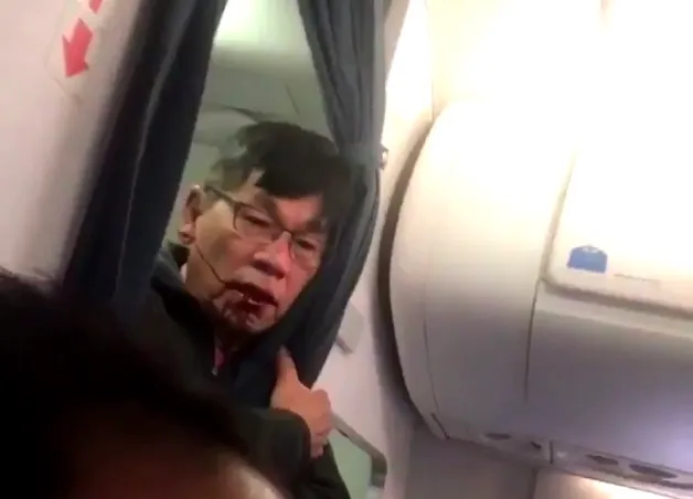 Video shows man dragged from United flight had bloodied face