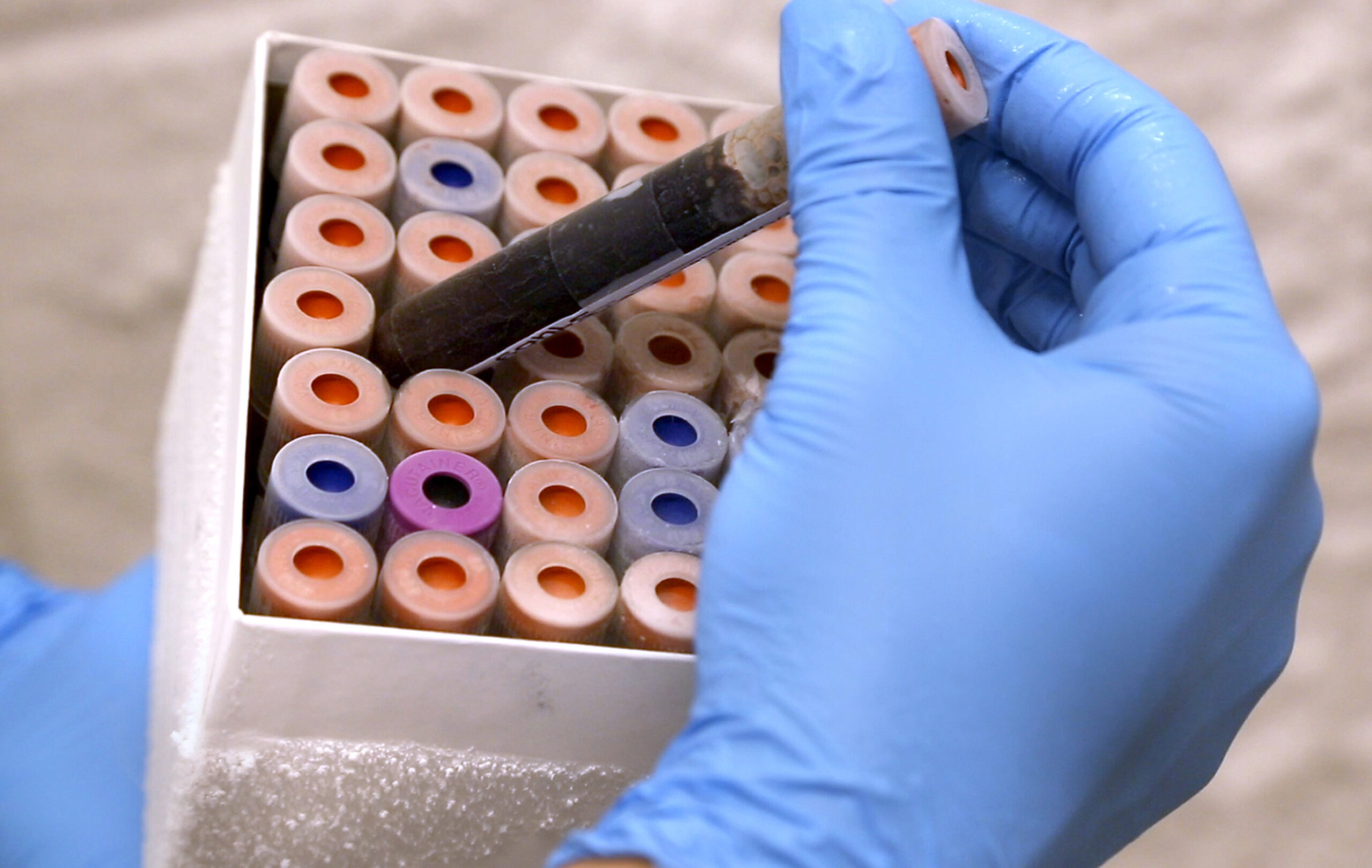 New test aims to better detect viral infections
