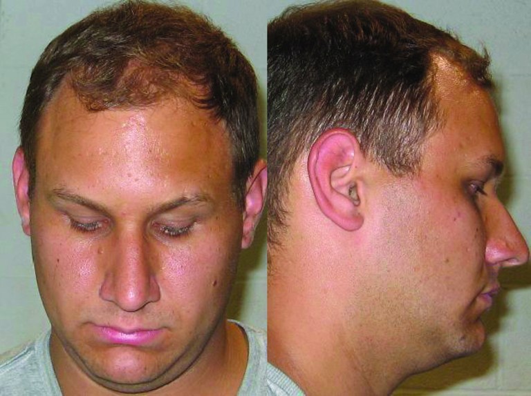 This undated photo released by the Shaker Heights police department shows the booking photo of Andrew Martin. Martin, 23, of Bristolville, near Warren, Ohio, allegedly tried to resolve a house ownership fight by offering $10,000 to kill the dead owner's sister. Martin has pleaded not guilty and his trial is scheduled Feb. 7 in U.S. District Court in Cleveland. (AP Photo/Shaker Heights Police Department)