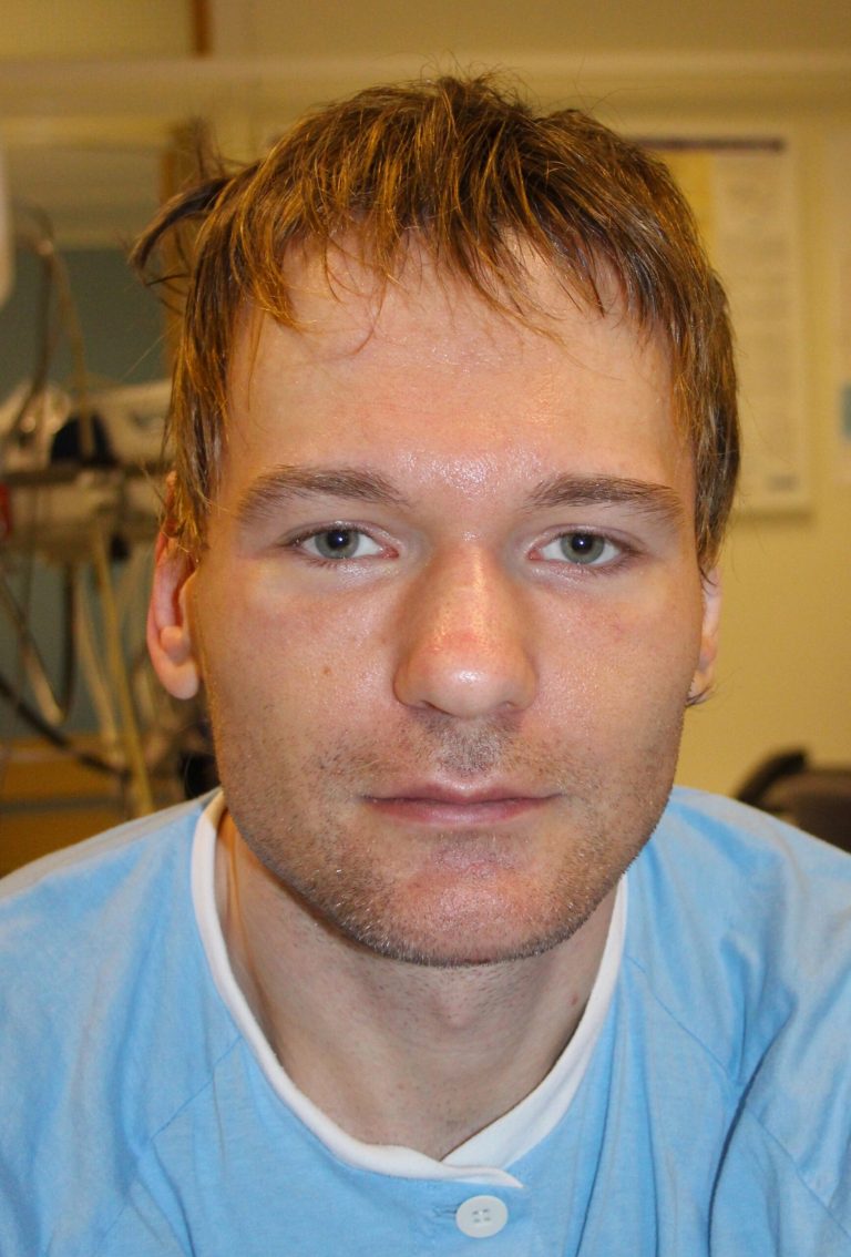 Picture distributed by Norwegian police, Tuesday April 8, 2014, shows a man who understands five languages but claims he can't remember his own name. According to police the man in his mid-twenties was found abandoned in bad condition in the snow in Oslo in December 2013, he speaks with an eastern European accent but is unable to remember who he is, so police are seeking help from the public to identify him. (AP Photo / Norwegian Police)