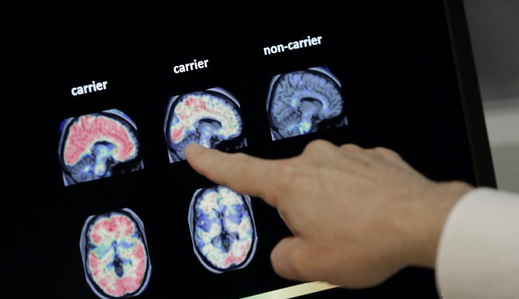 America has an Alzheimer’s problem. Can Trump fix it?