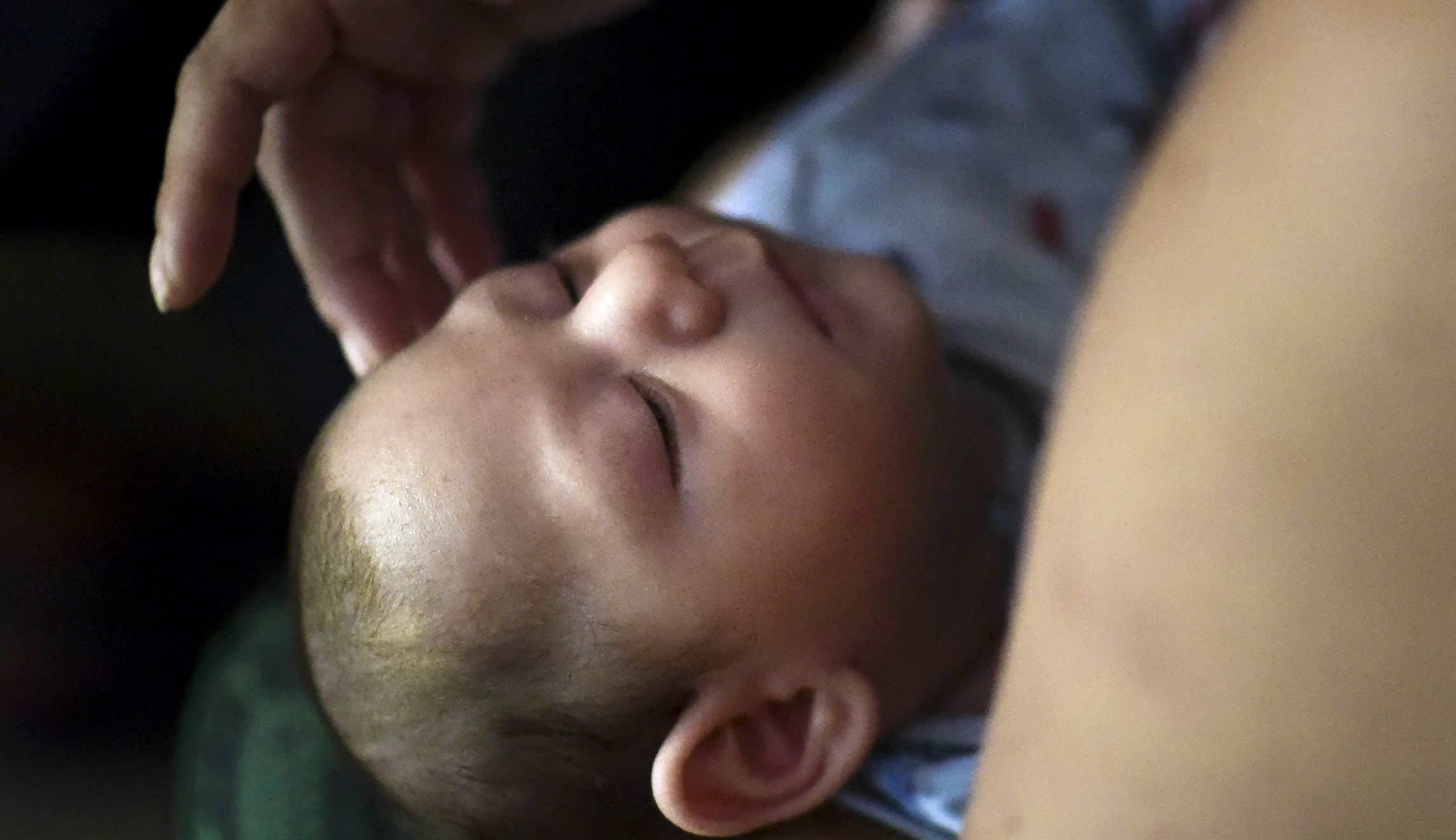 CDC study finds Zika virus leading to long-term health problems for babies
