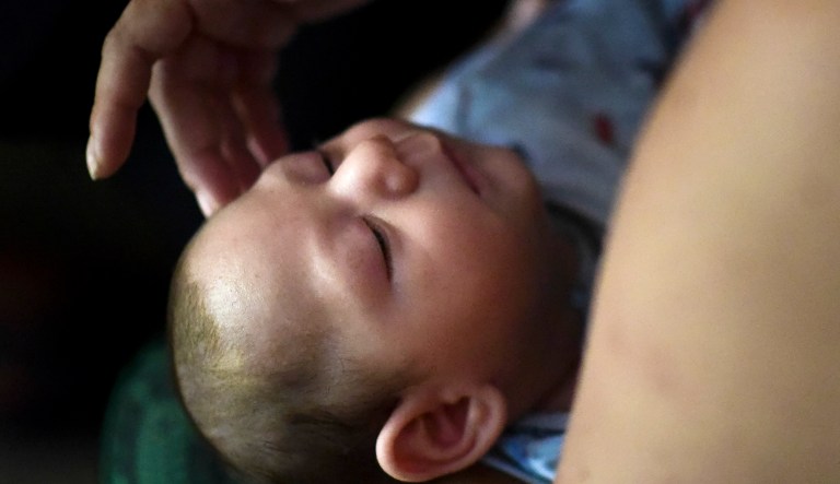 Puerto Rico resident Michelle Flandez caresses her two-month-old son Inti Perez (pictured center), diagnosed with microcephaly linked to the mosquito-borne Zika virus, in Bayamon, Puerto Rico. 