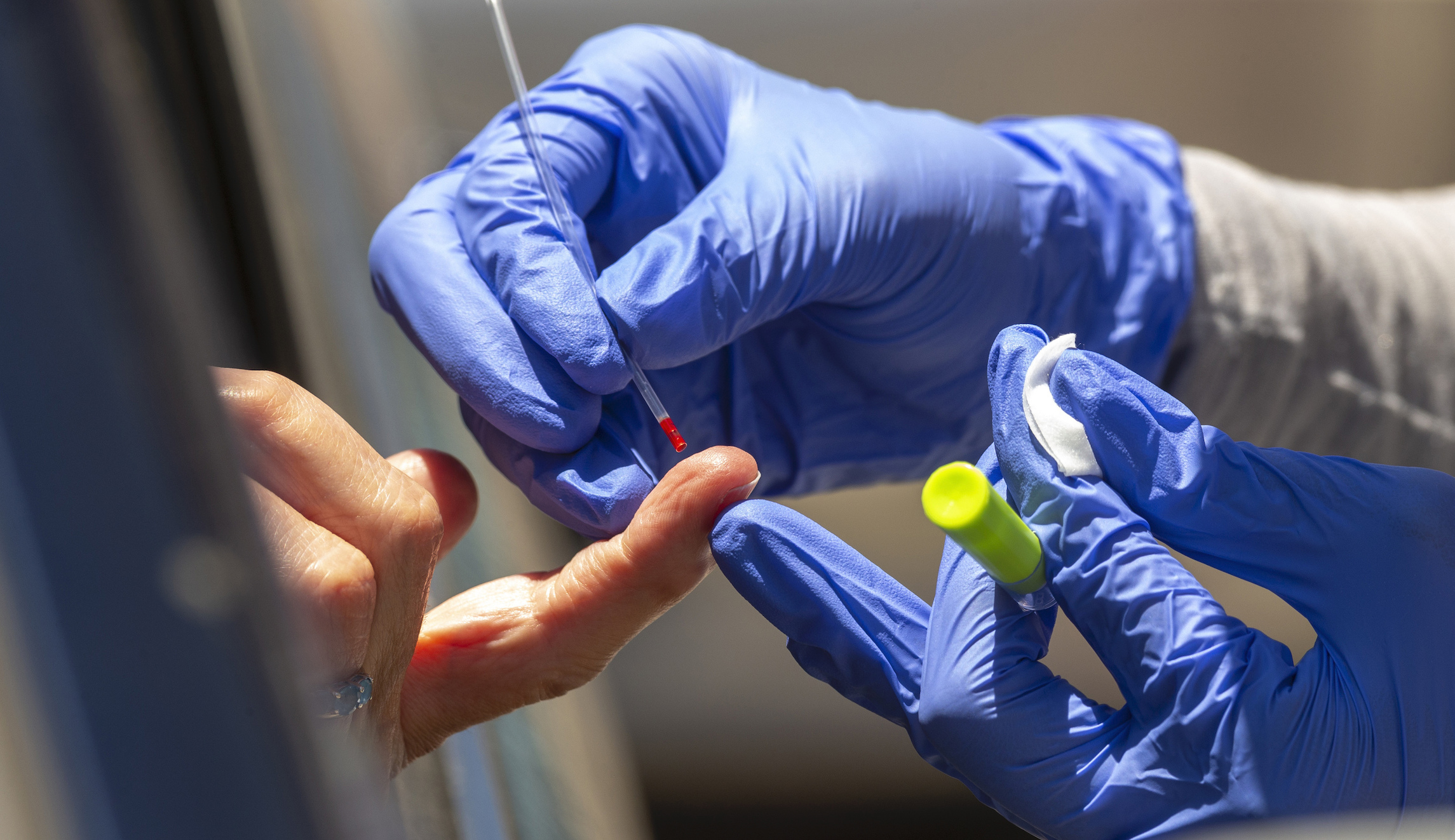 CDC warns employers against depending on antibody tests when allowing workers to return