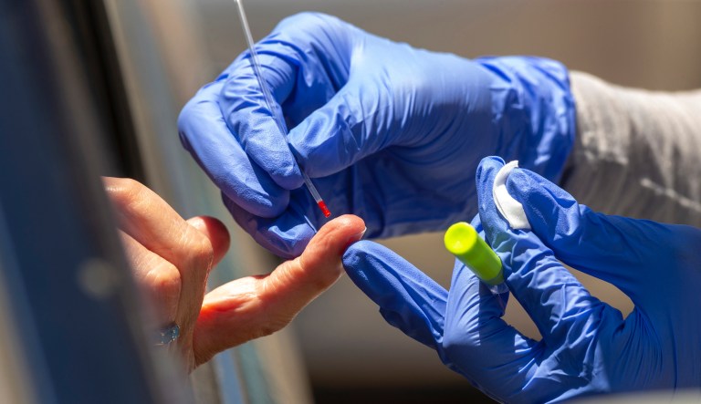 CDC warns employers against depending on antibody tests when allowing workers to return