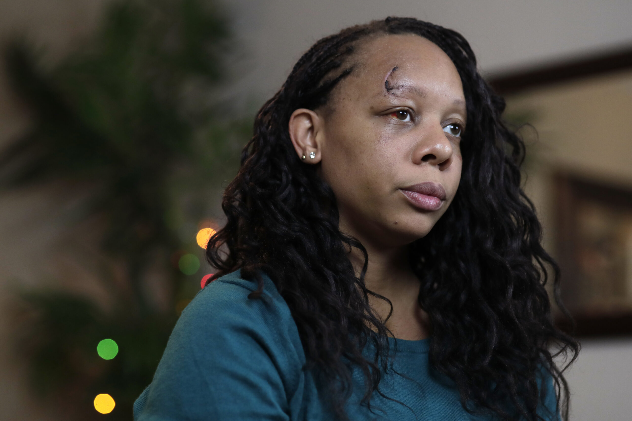 Officer who shot protester in the face with rubber bullet ‘exonerated,’ chief says