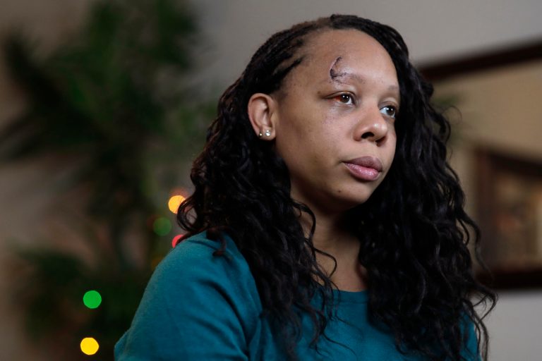 Officer who shot protester in the face with rubber bullet ‘exonerated,’ chief says