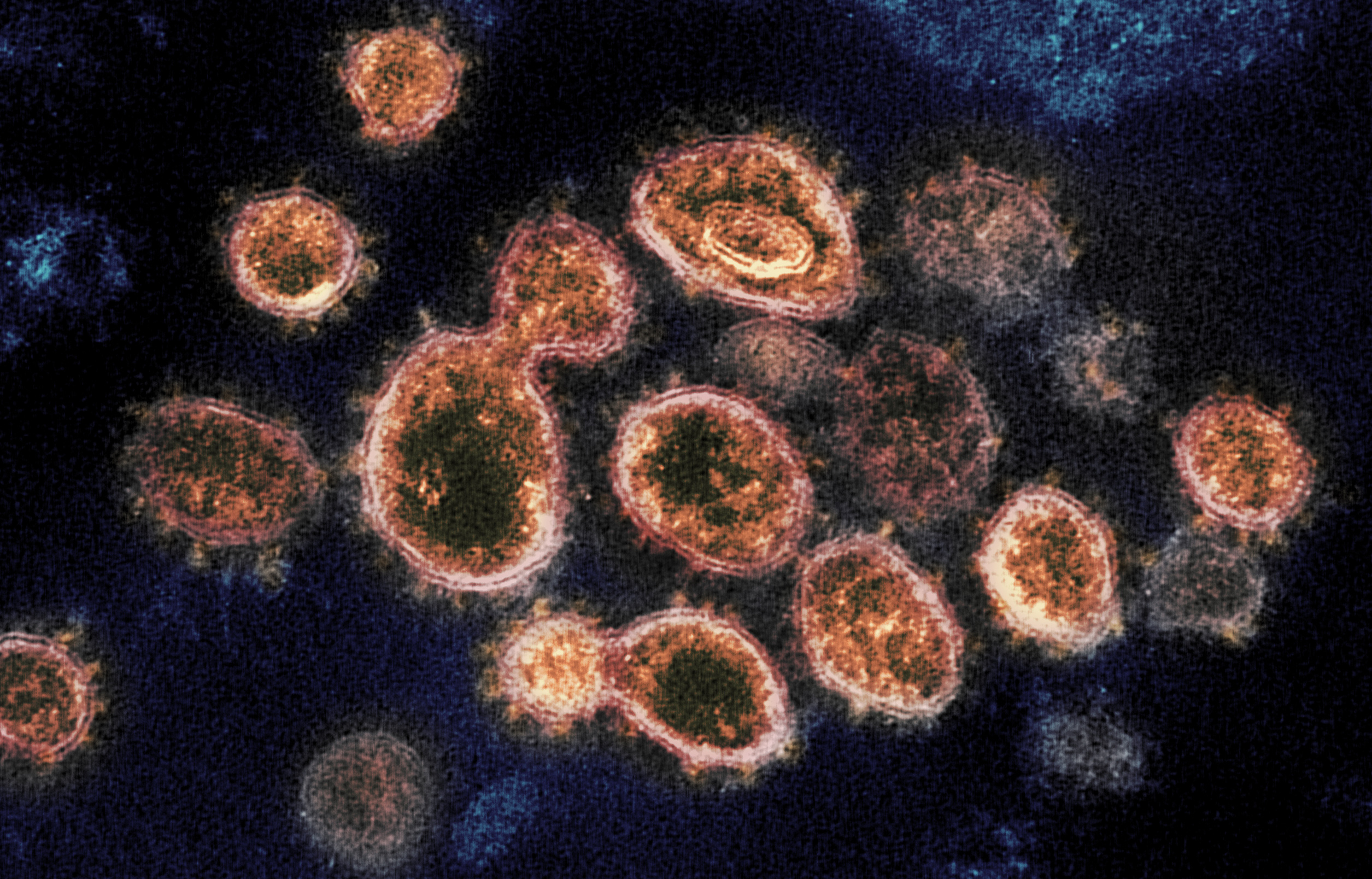 US reaches 73% immunity to omicron variant
