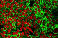 Cancer among adults under 50 surged by 79%: Study