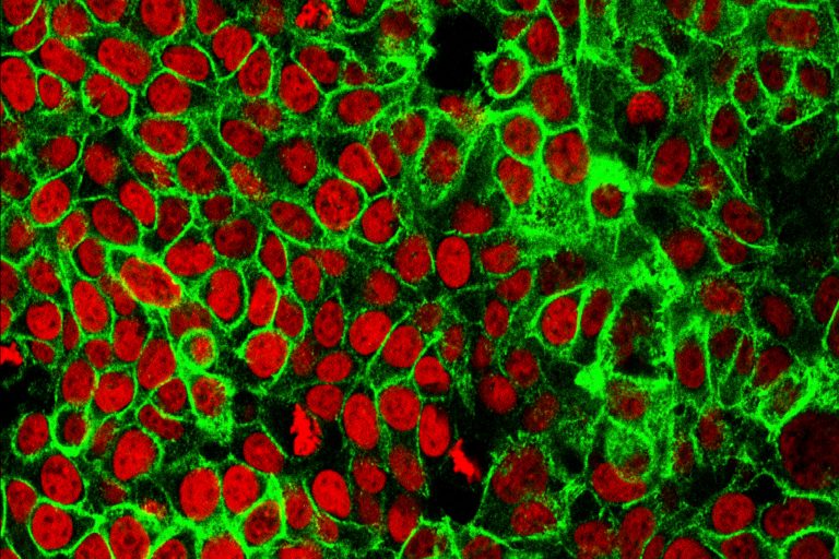 Cancer among adults under 50 surged by 79%: Study
