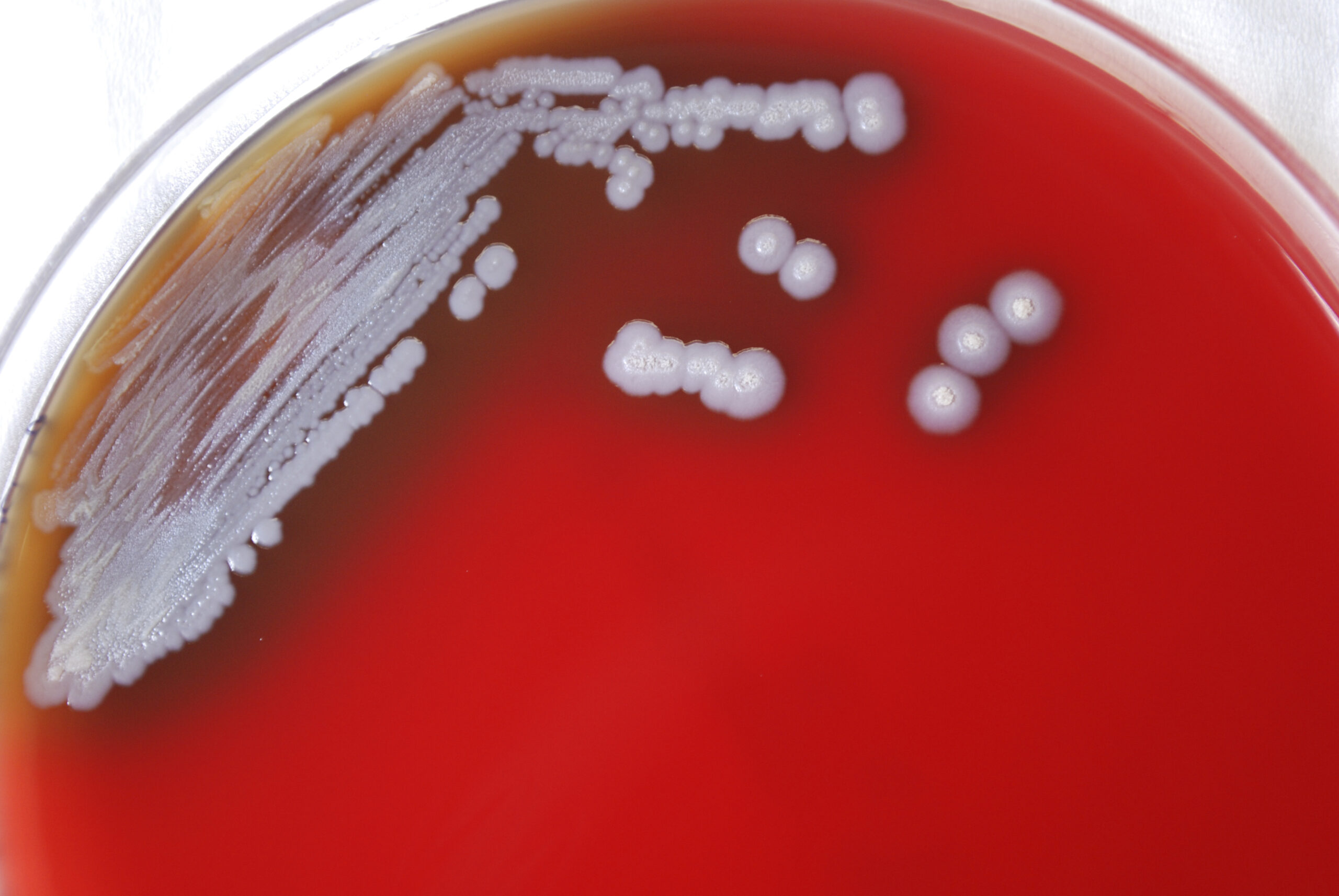 CDC identifies possibly deadly bacterium for the first time in US
