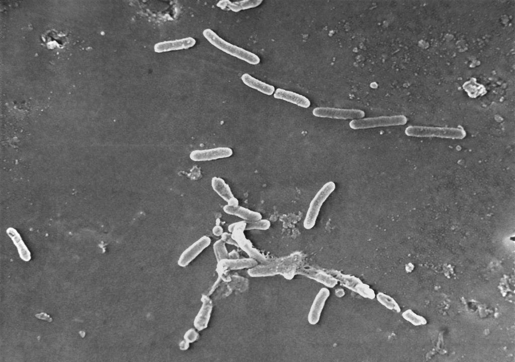 Three dead after using eyedrops contaminated with rare superbug
