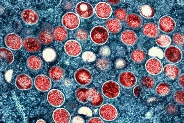This colorized electron microscope image provided by the National Institute of Allergy and Infectious Diseases shows mpox particles, red, found within an infected cell, blue, cultured in a laboratory in Fort Detrick, Maryland.