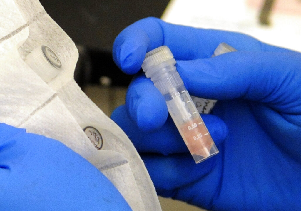 Rare fungal outbreak in Michigan suspected to affect nearly 100 paper mill workers