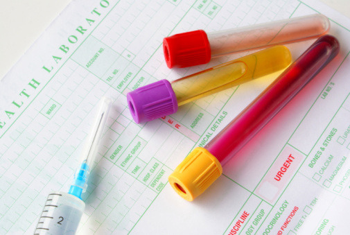 Drug testing for food stamp applicants added to House farm bill