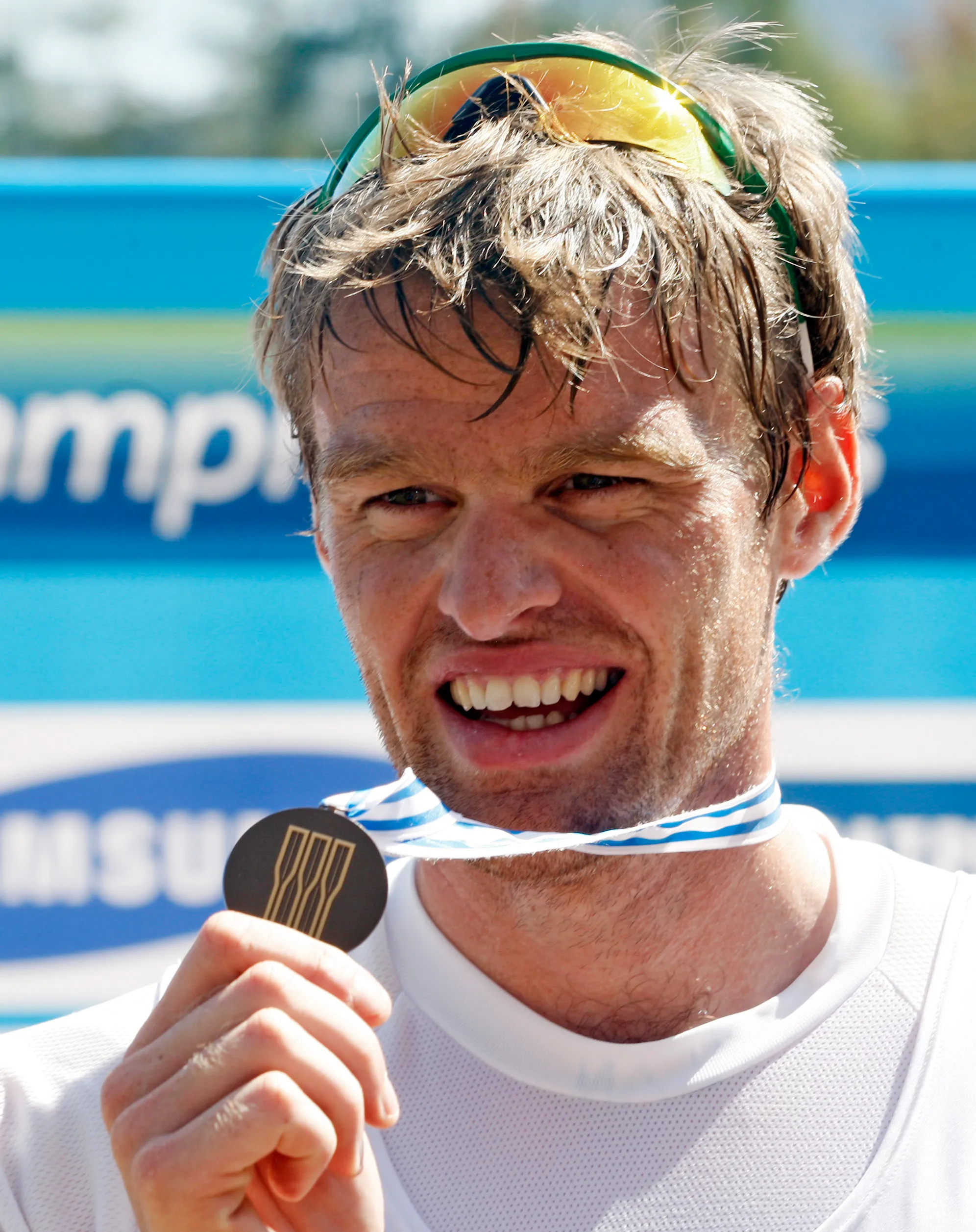 The paradox of Olympians’ “garbage” teeth