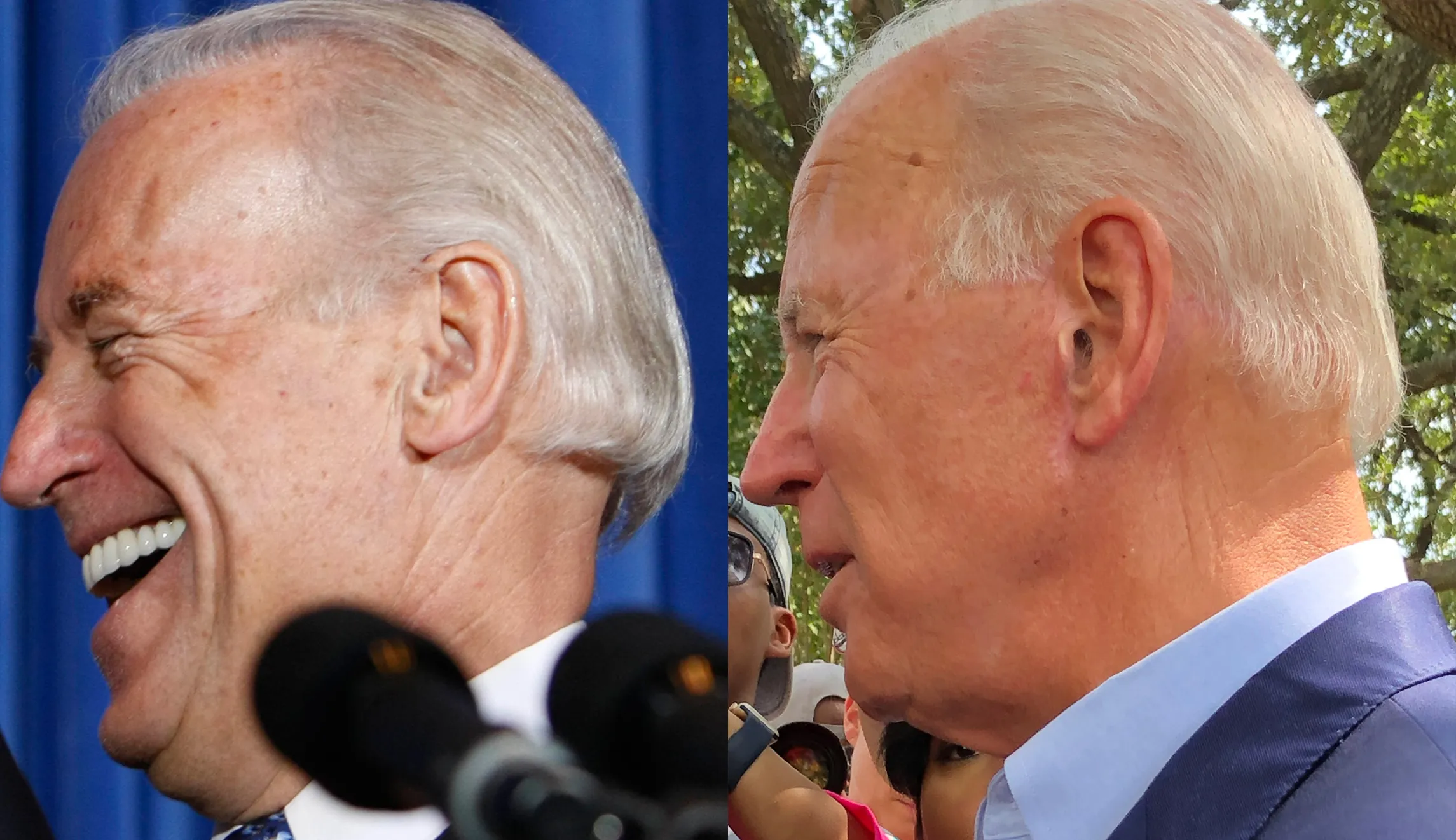 Joe Biden facelift embed