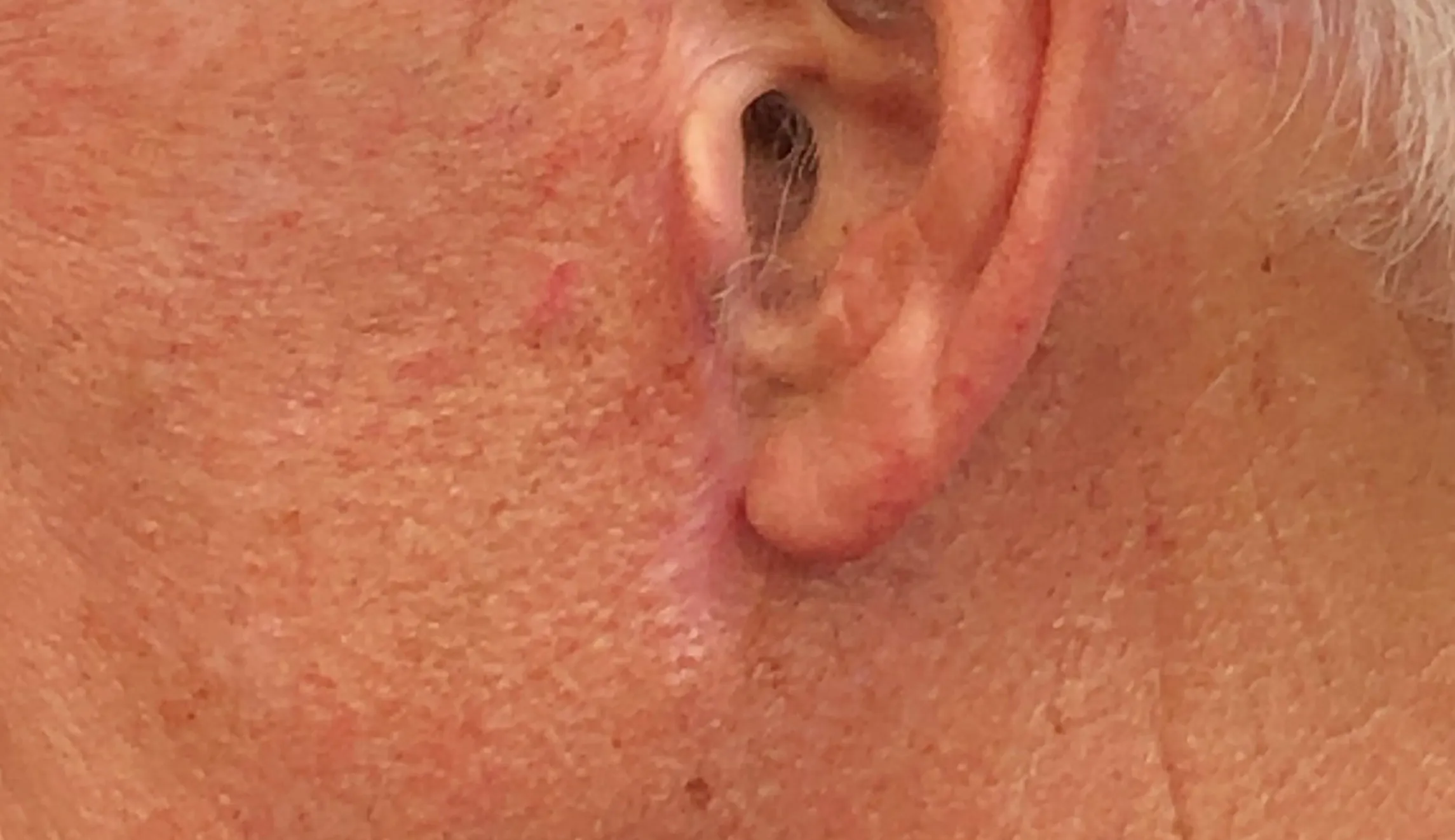 Joe Biden scar embed