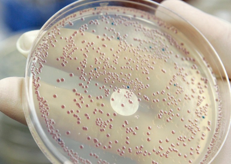 Company wants to bypass the entire plant-growing process to expedite biofuel production, which it says is possible by manipulating the E. coli bacteria. (AP Photo/Nati Harnik)