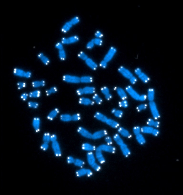   This undated image made available by the NIH's National Cancer Institute shows the 46 human chromosomes in blue, with telomeres appearing as white points on the ends. Some previous studies have associated having longer telomeres with better health and longer lives. Telomeres haven't been proven to cause those benefits in the general population, but a number of researchers think they may hold secrets for things like longevity and cancer. (AP Photo/NIH, National Cancer Institute, Hesed Padilla-Nash, Thomas Ried)  